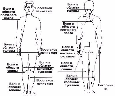 Точечный массаж при артрите, его особенности Точечный массаж при артрите, его особенности
