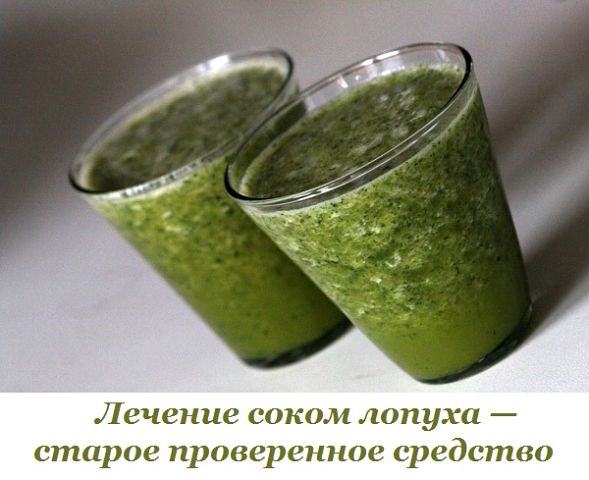 Лечение соком лопуха — старое проверенное средство Лечение соком лопуха — старое проверенное средство
